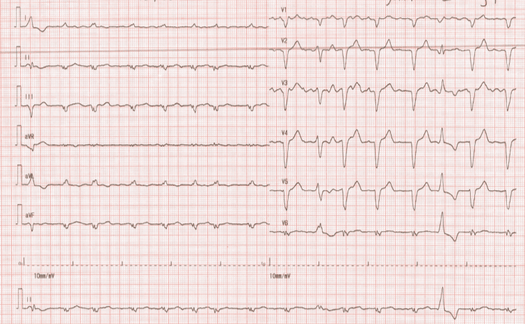 icu2_rxt