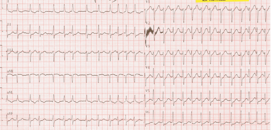 icu2_rxt